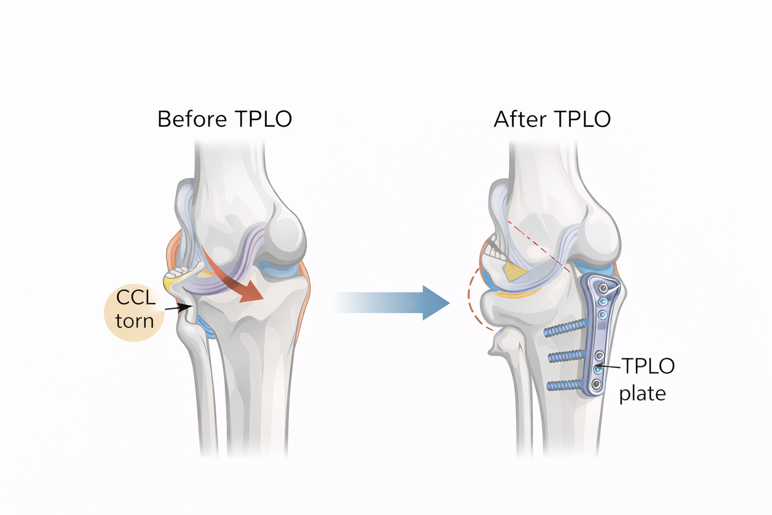 Comparison before and after TPLO